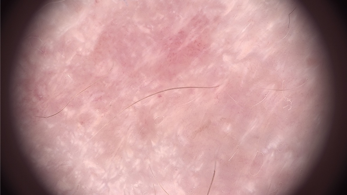 Medical consultation