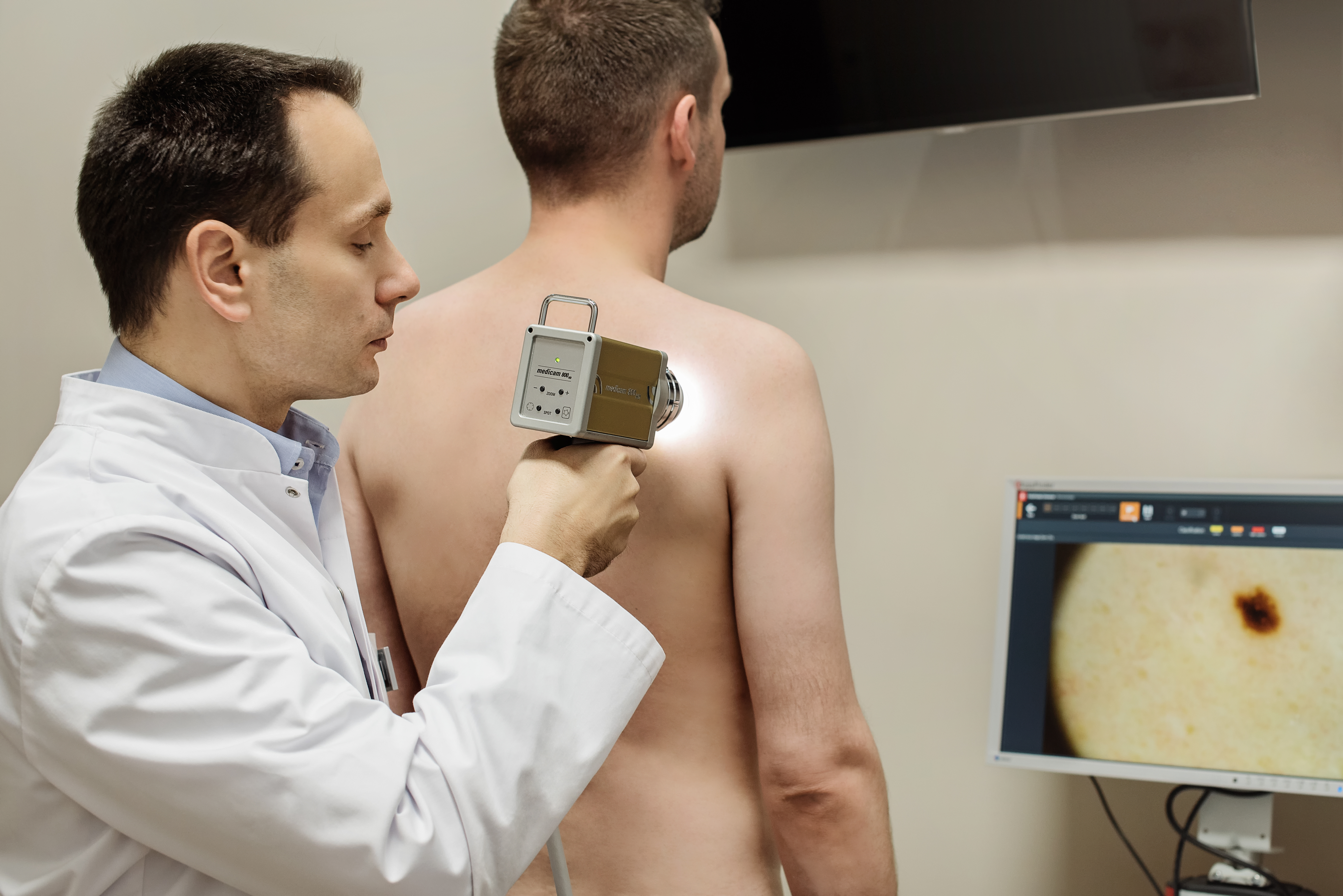 Adult skin mapping exam