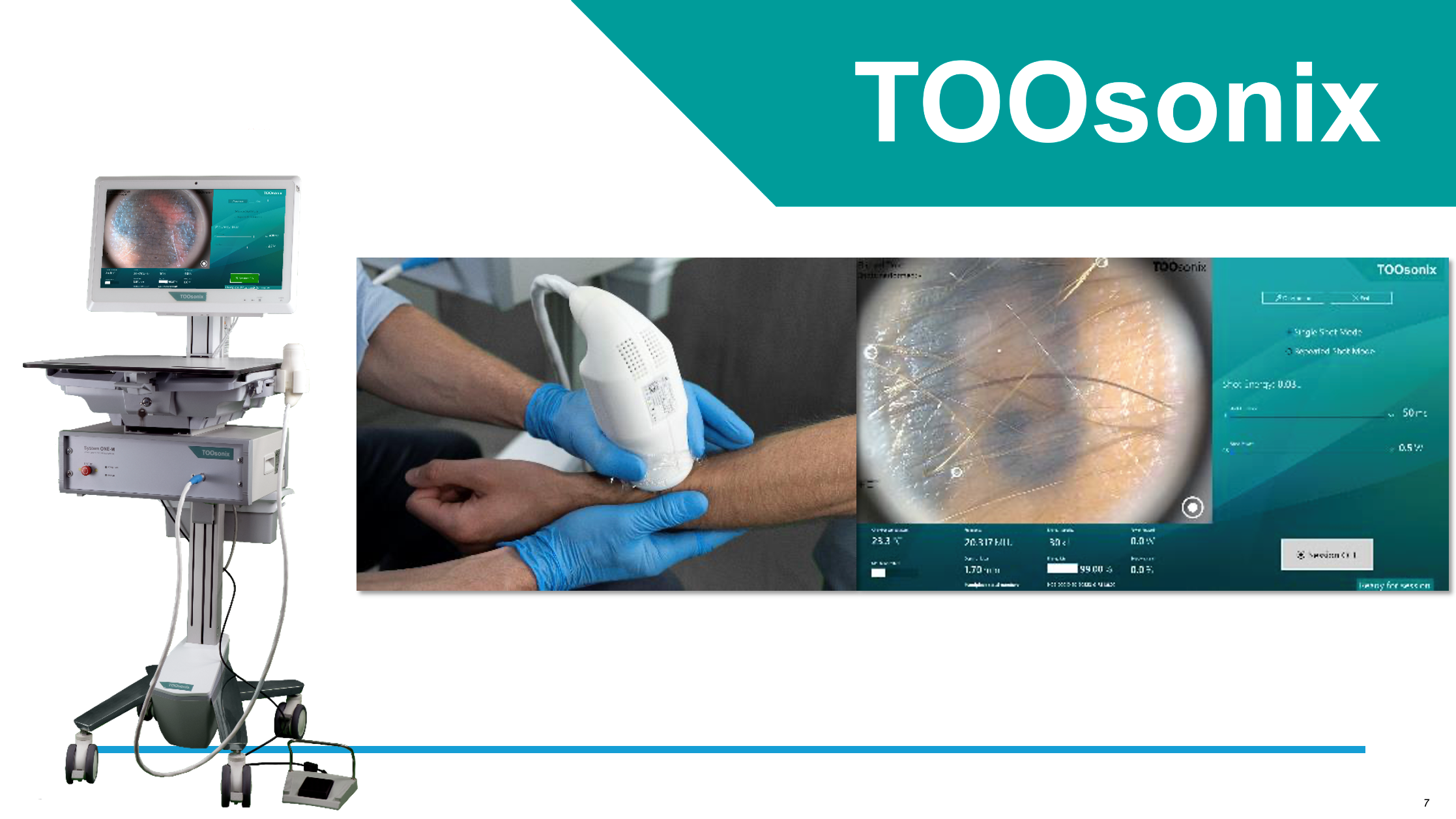 High-precision skin procedure planning