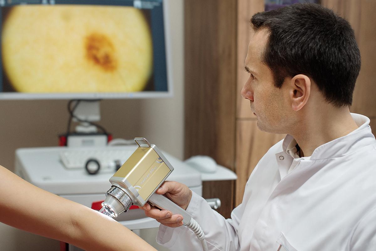 Videodermatoscopy at Old Town Clinic